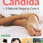 10 Signs You Have Candida + 3 Steps to Naturally Cure It | Avocadu.com