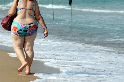 overweight woman with cellulite