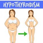 How to lose weight with Hyperthyroidism | Diet Plans for women to lose weight with thyroid problems | Avocadu.com