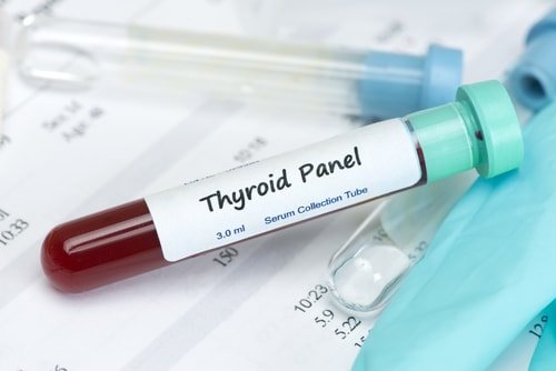 thyroid blood test for hypothyroidism
