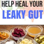 10 Foods that help heal your leaky gut | Gut health is connected to weight loss, mental health, and so much more | Avocadu.com