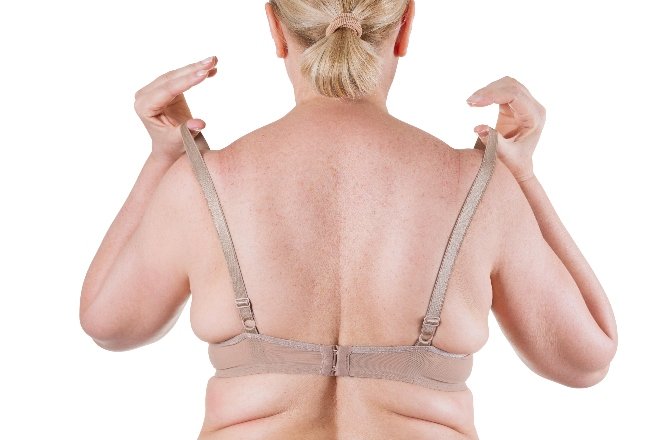 The Truth About Back Fat: What Causes Back Fat Under Your Bra