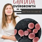 Candida-Overgrowth-Symptoms-PINTEREST