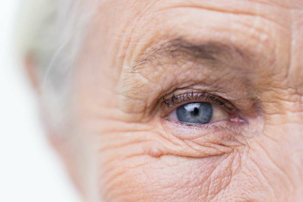 Benefits of Vitamin E eye health