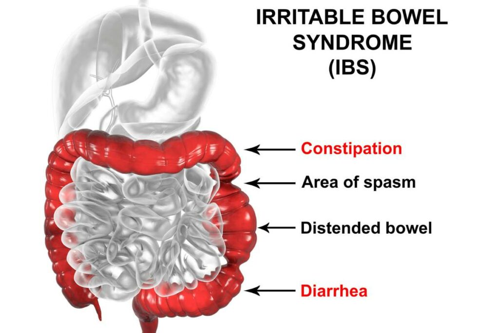 Probiotics for Digestive Disorders uncomfortable symptoms
