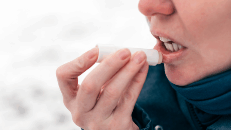 15 Lip Balms and Treatments To Survive November Wind