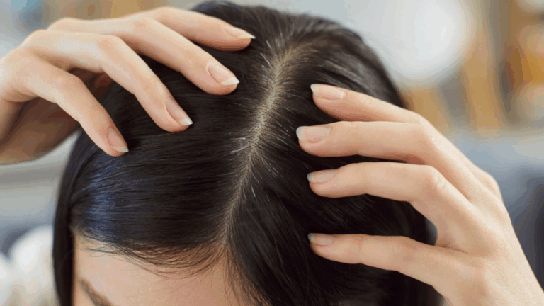 14 January Scalp Care Tips That People Forget