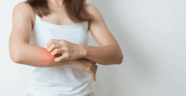 13 Late January Body Care Habits That Help with Rough, Itchy Skin