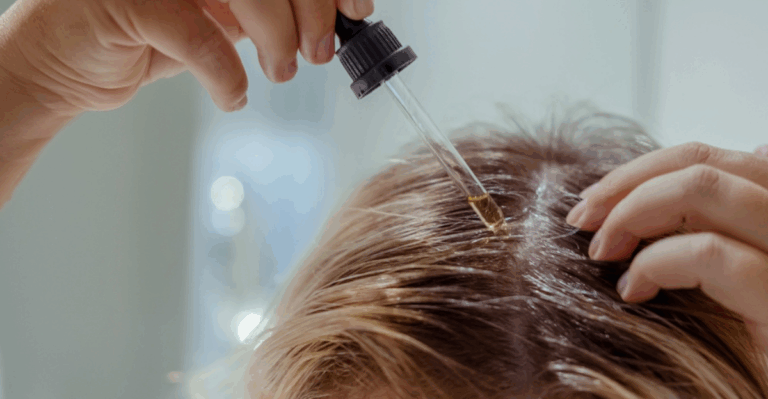 13 Late Winter Scalp Care Ideas to Combat Flakes and Itch