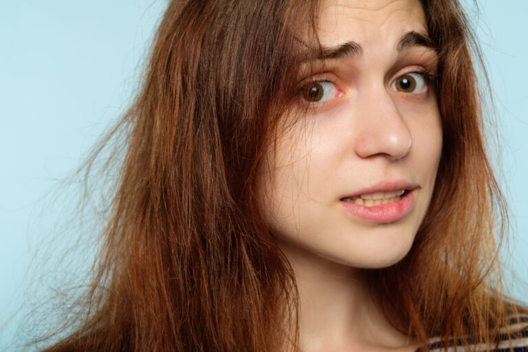 13 Winter Hair Problems and Small Fixes That Help